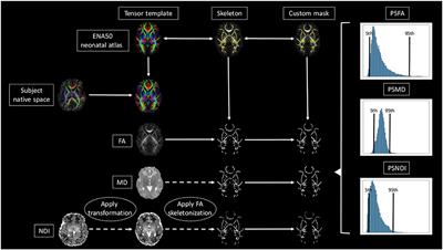 Peak Width of Skeletonized Water Diffusion MRI in the Neonatal Brain